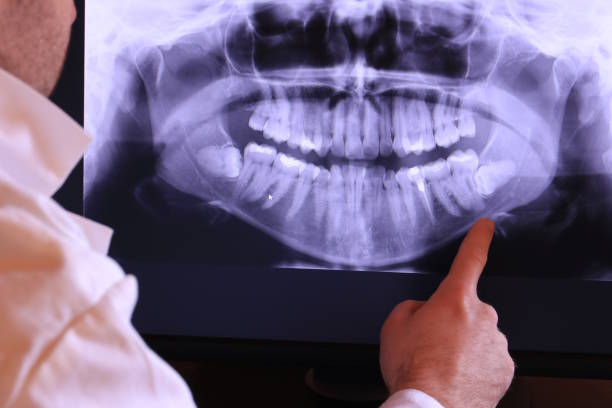 Best Emergency Dentist for Lost Fillings or Crowns in Rolling Hills Estates, CA