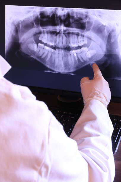 Best Emergency Dentist for Special Needs Patients in Rolling Hills Estates, CA